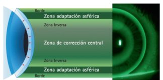 lentes de contacto tóricas