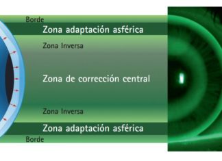 lentes de contacto tóricas