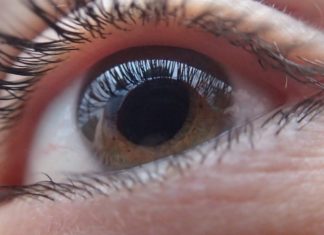 Prevención glaucoma